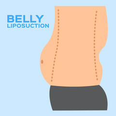 liposuction body set . vector