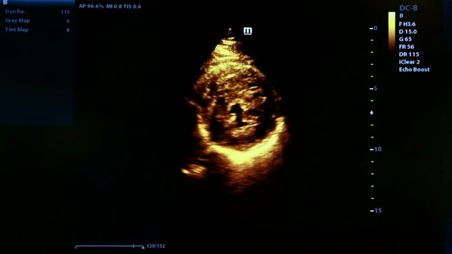 Colourful footage of pregnancy ultrasound monitor