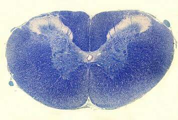 Spinal cord. Luxol Fast Blue stain