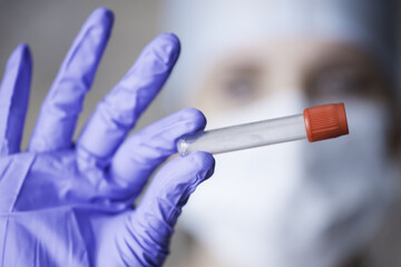 Medical concept: a doctor in blue rubber gloves holds a test tube with a tick