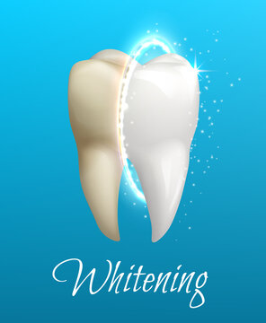 Teeth whitening concept with clean and dirty tooth
