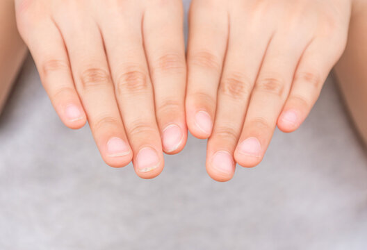 Four fingers at a right hand nails long and dirty. Four fingers at left with short nails and clean. Kids should cut nails short and clean, keep good hygiene.