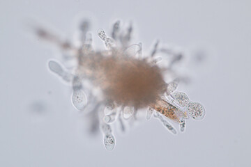 Amoebae move and feed by using pseudopods, which are bulges of cytoplasm formed by the coordinated...