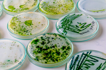 Filament and colony of phycology in medium culture plate.