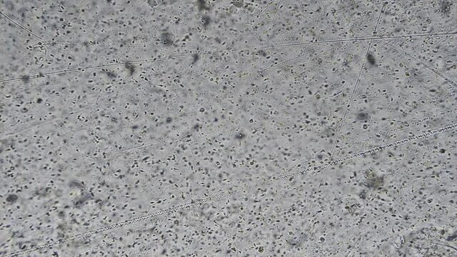 The Microscopic World. Sperm under the microscope.
