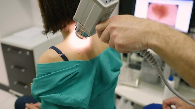 melanoma diagnosis. examination of birthmarks and moles.the doctor examines the patient's mole