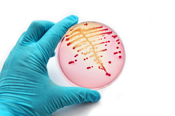 Colonies of bacteria in petri dish
