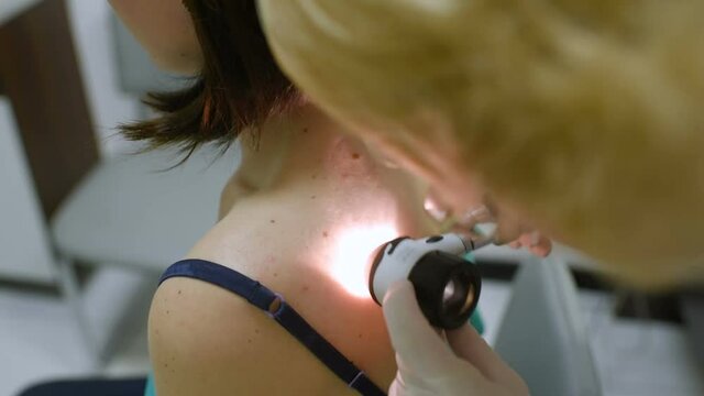 melanoma diagnosis.Doctor examining birthmarks and moles patient