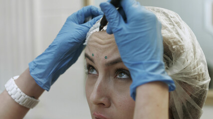 Cosmetologist indicates zones for further injections on the patient's forehead