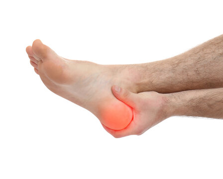 Concept of orthopedist. Man suffering from pain in heel on white background