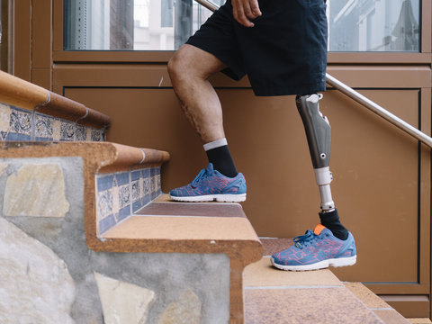 Disable man with a prosthetic equipment