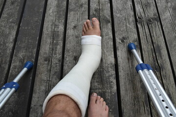 骨折した足