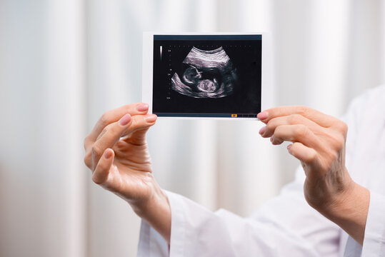 partial view of doctor holding scan of baby in hands