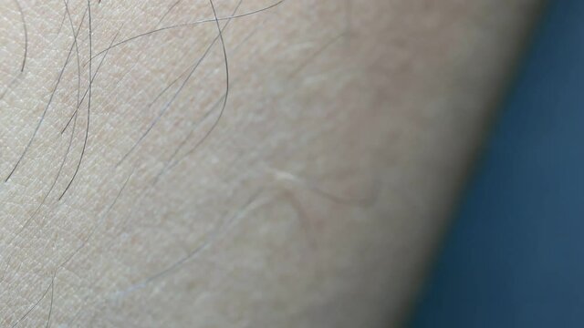 Close up of Human Skin Texture 
