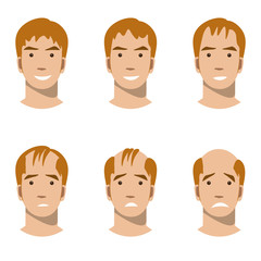 Stages of hair loss and hair treatment