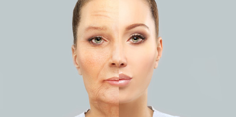 Aging. Mature woman-young woman.Face with skin problem 