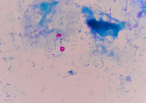 red cells cryptosporidium oocyte