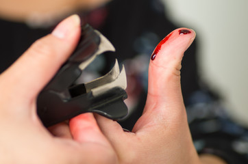 Fototapeta premium Close up of a woman injured her finger using a black staple puller