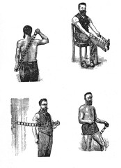 Chain massage, vintage illustration