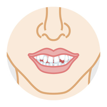 Bad dentition,Face close-up