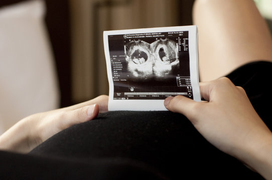 A pregnant woman wearing a black dress is holding a sonogram