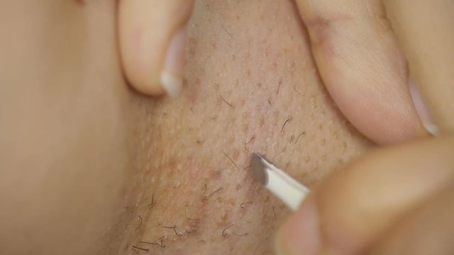 slow motion of close-up women plucking a hair off her chicken armpit skin