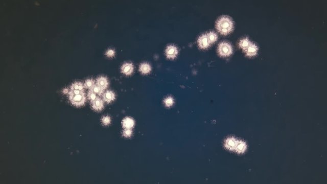 Growing Bacterial Colonies In Petri Dish, Time Lapse