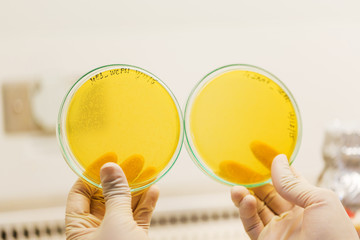 Scientist holding Agar plate full of bacterias in Laminar