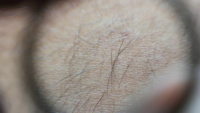 Close up of Human Skin Texture 
