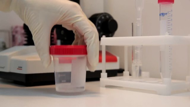 A doctor prepares a semen sample