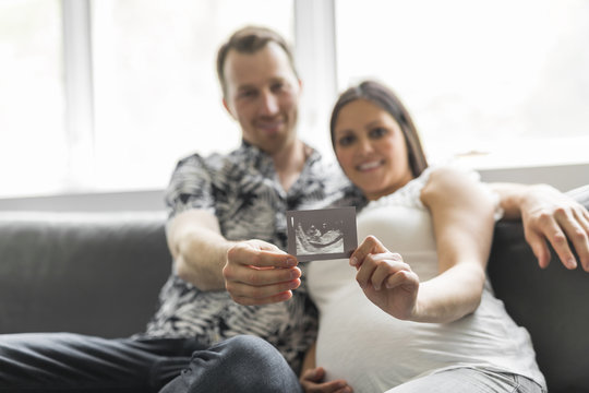 Happy couple are holding ultrasound scan of their baby.