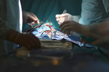 The final phase of the surgery to the abdomen