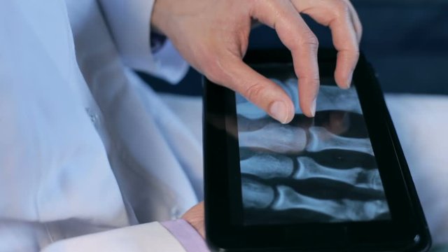 Doctor radiologist watching x-ray image on the tablet