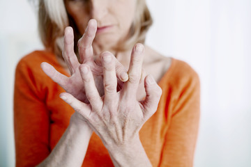 Elderly person with painful hand - obrazy, fototapety, plakaty