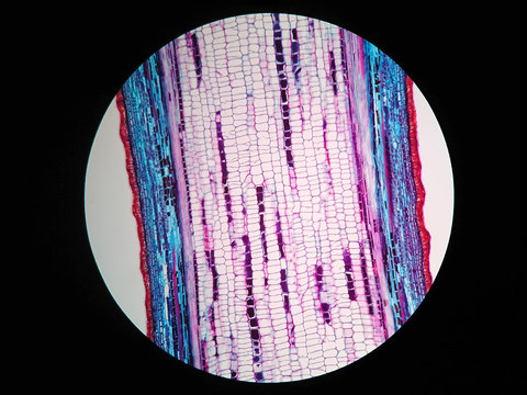 Plant stem, long section under microscope view