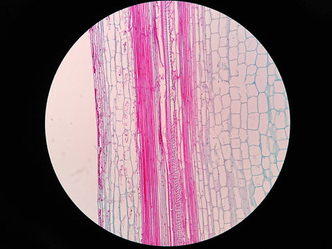 Plant stem, long section under microscope view