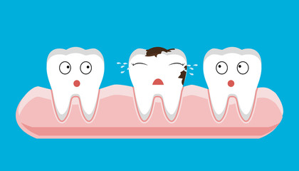 illustration of tooth sectional view decay with caries dental health problem - vector