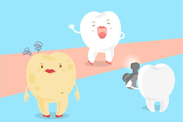 cartoon tooth with paparazzi