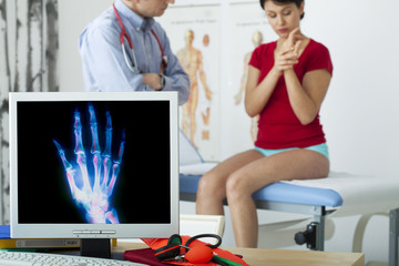 Models On screen, colorized x-ray of the hand with arthrosis