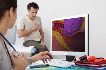 Models On screen, drawing representing an artery obstructed following a stenosis caused by the...