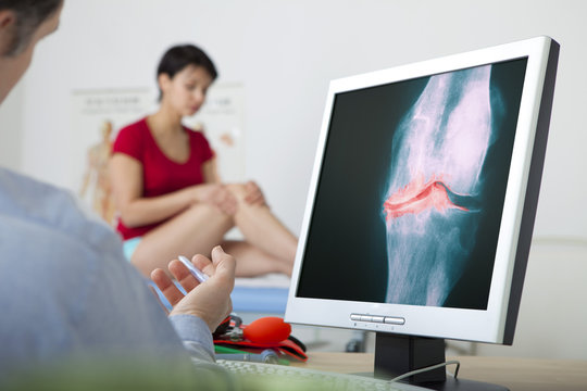 Models On screen, x-ray of a knee arthrosis