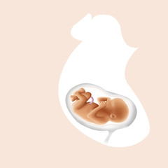 Shoulder presentation This fetal presentation is called transverse presentation when the amniotic sac is intact and shoulder presentation when it is torn