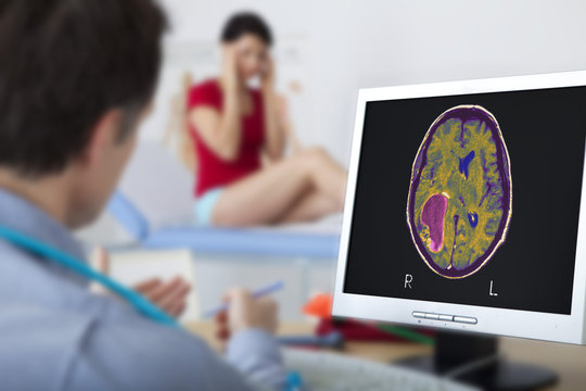 Models On Screen, Cerebral MRI Showing A Tumor (glioblastoma)