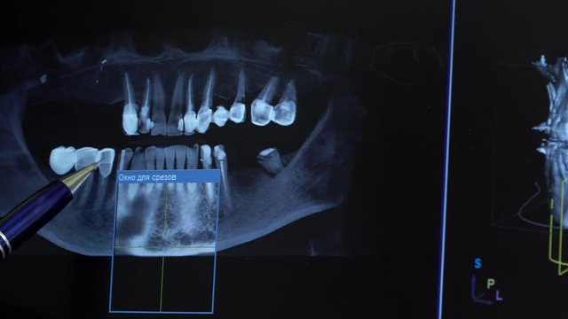The woman the dentist shows to the patient a x-ray picture of his teeth on the computer