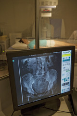 Centre de Radiologie et d'Imagerie M￩dicale ￠ Paris Examen radiologique