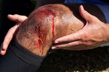 Close up of rugby player with injured knee - Powered by Adobe