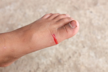 Blood from child's foot caused by the accident.