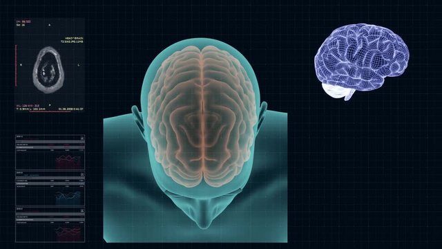 MRI of the human brain in the axial projection, high-tech concept