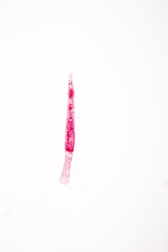 Dactylogyrus sp.on slide under microscope view.	