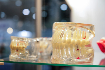 Dental jaw model on glass shelf